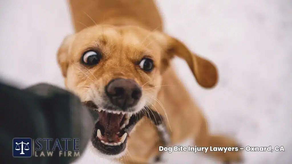 Abogados de lesiones por mordeduras de perro – Oxnard, CA 1 Dog Bite Injury Lawyers – Oxnard, CA