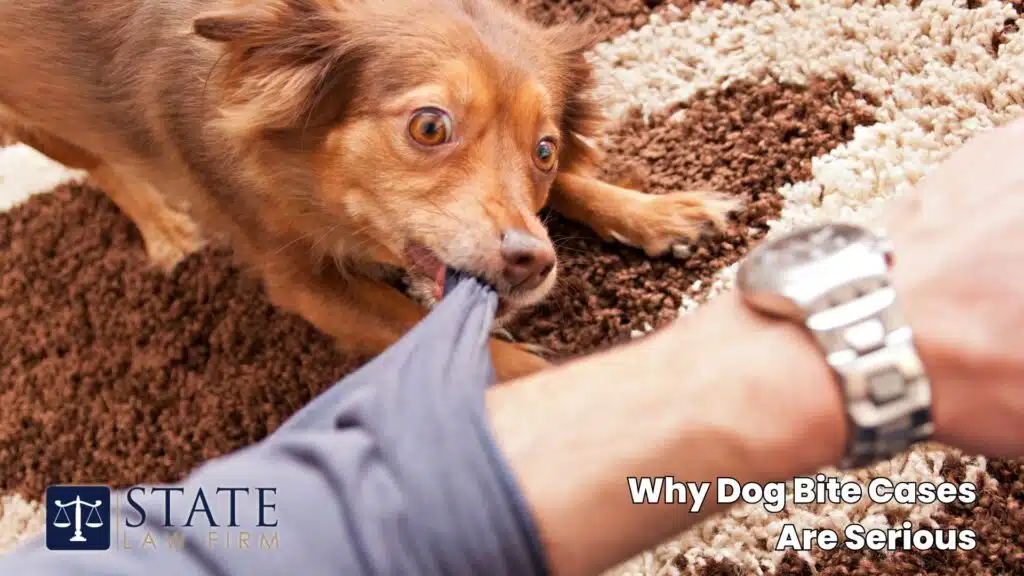 Dog Bite Injury Lawyers – Santa Barbara, CA 2 Why Dog Bite Cases Are Serious