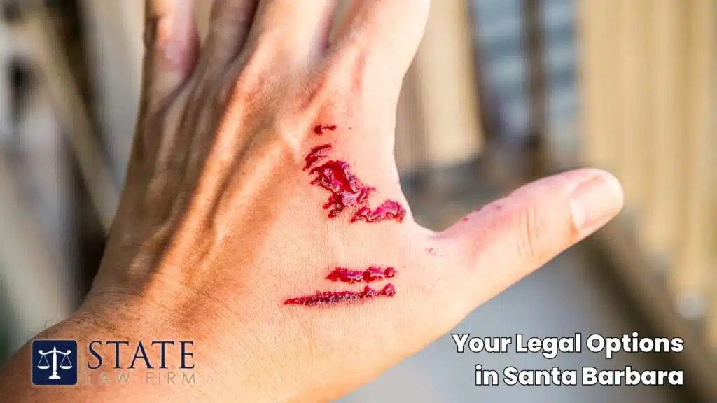 Dog Bite Injury Lawyers – Santa Barbara, CA 4 Your Legal Options in Santa Barbara