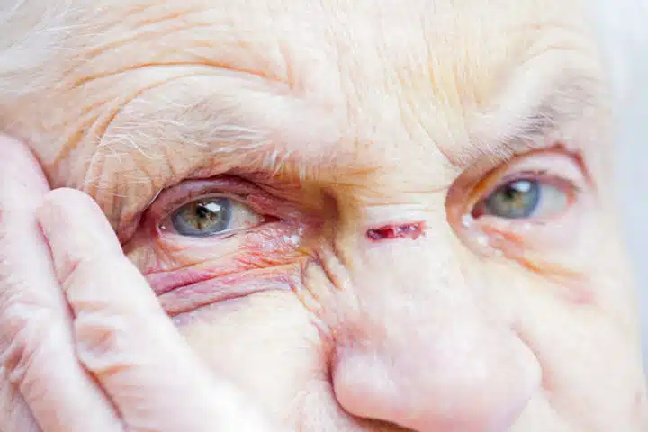 Elderly person sufering from abuse
