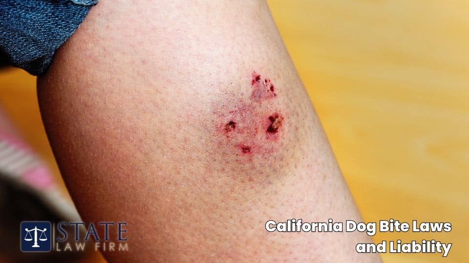 California Dog Bite Laws and Liability
