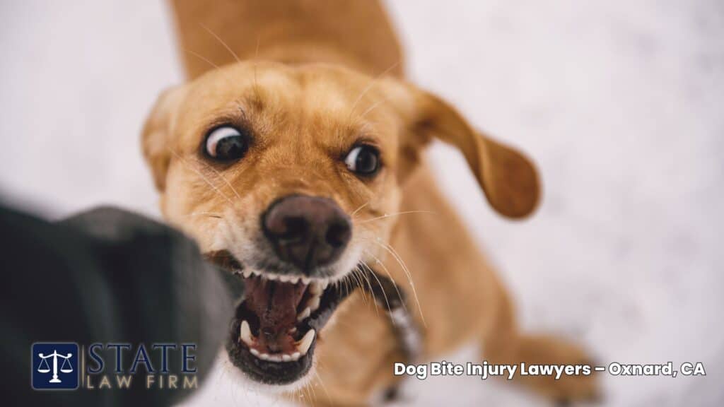 Abogados de lesiones por mordeduras de perro – Oxnard, CA 1 Abogados de lesiones por mordeduras de perro en Oxnard, CA