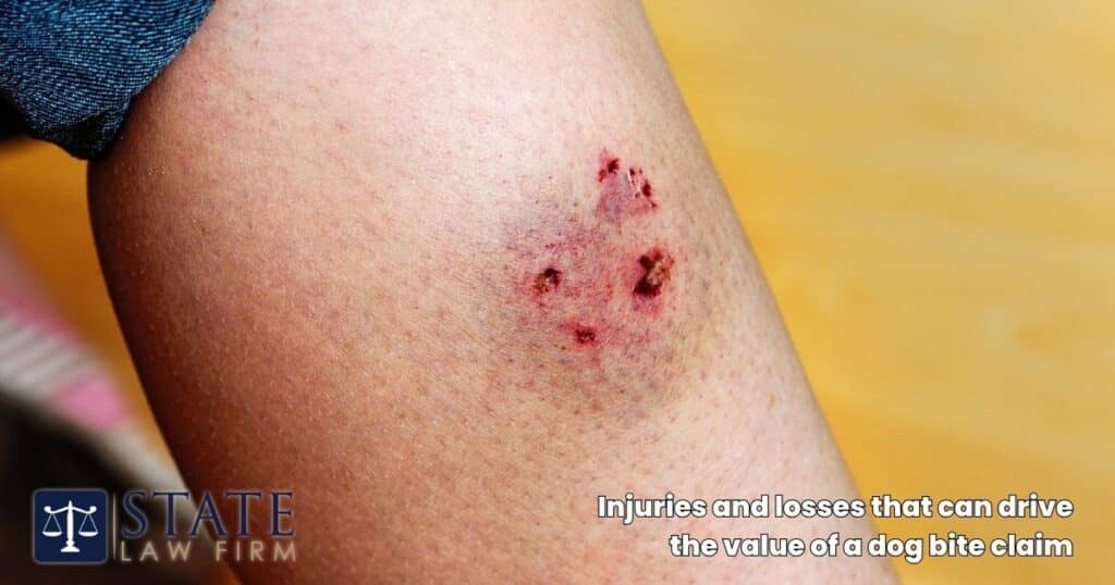 Injuries and losses that can drive the value of a dog bite claim