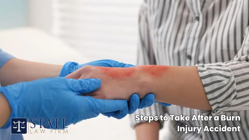 Steps to Take After a Burn Injury Accident