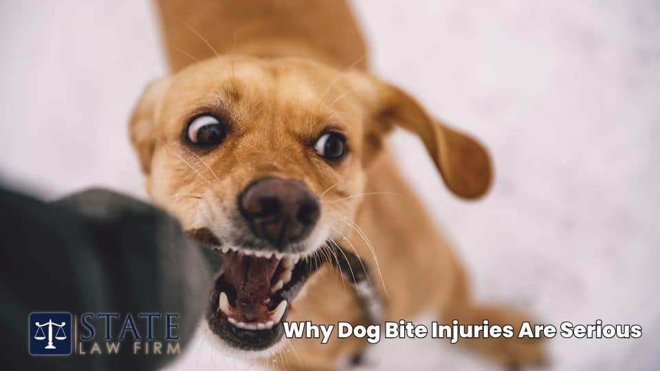 Why Dog Bite Injuries Are Serious