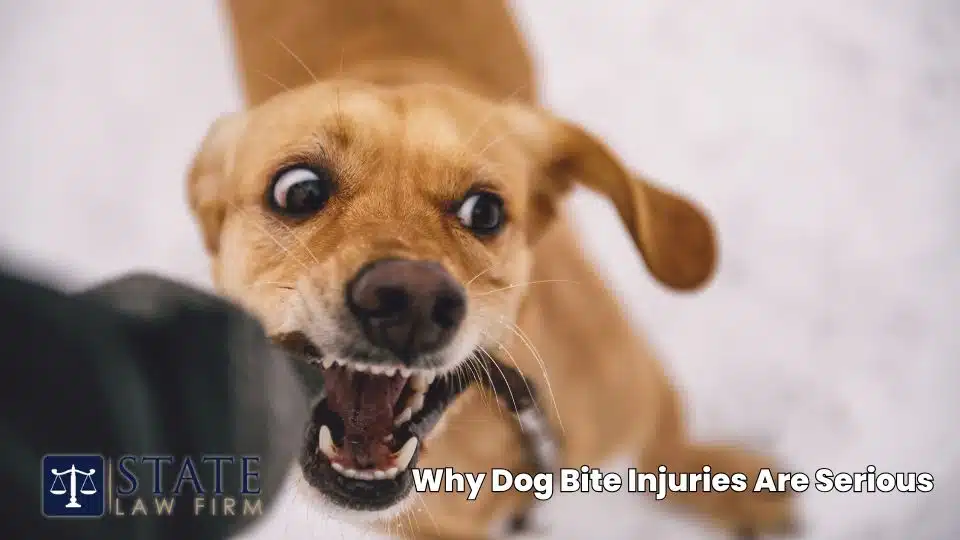 Abogados de lesiones por mordeduras de perro – Ventura, CA 2 ¿Por qué son graves las lesiones por mordeduras de perro?