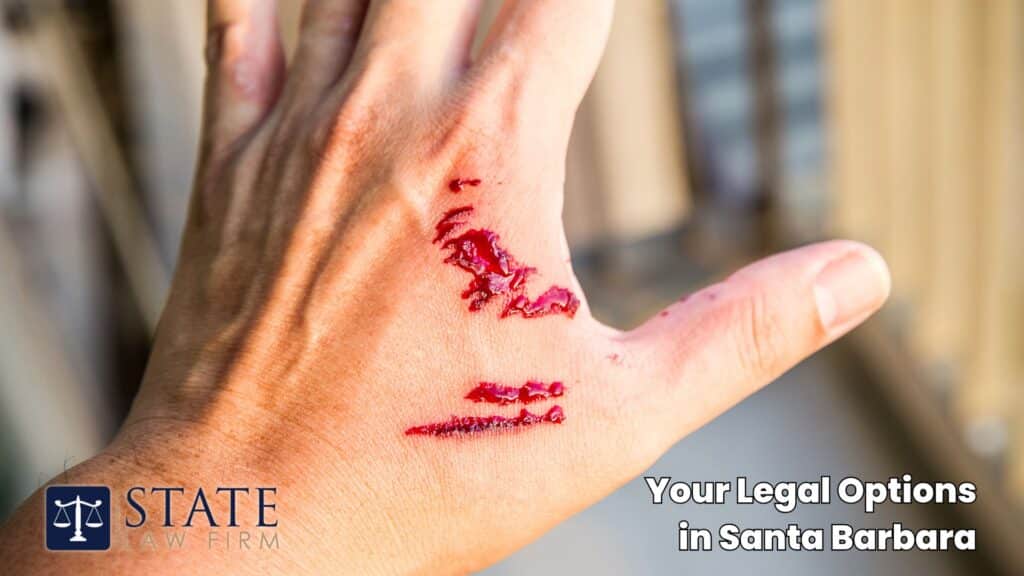 Abogados de lesiones por mordeduras de perro – Santa Bárbara, CA 4 Sus opciones legales en Santa Bárbara
