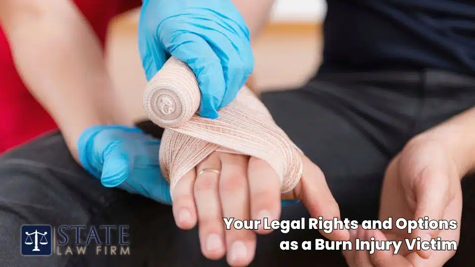 Your Legal Rights and Options as a Burn Injury Victim