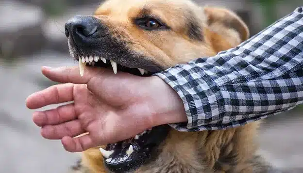 Dog Bite Injuries in California: Understanding the Risks, Laws, and Legal Support