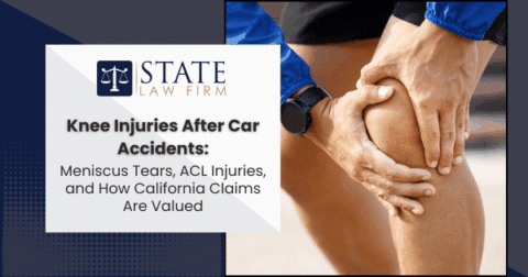 Knee injuries after car accident,