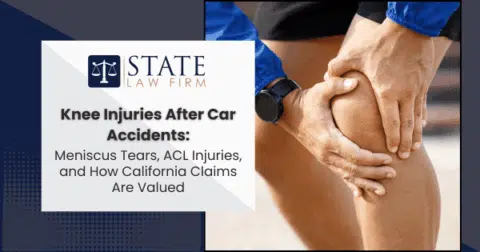 Knee injuries after car accident,