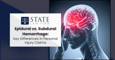 Person stressed about epidural vs sub decision