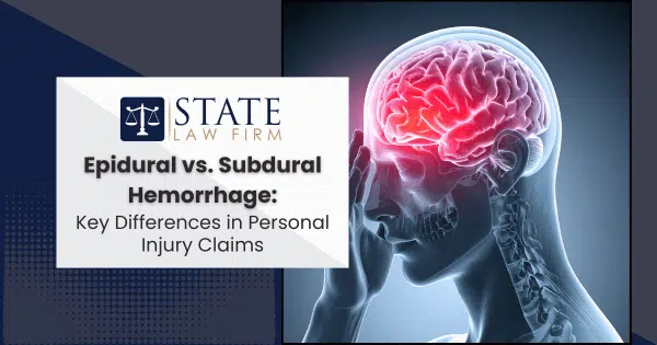Person stressed about epidural vs sub decision