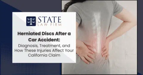 Woman holding her back with hands on her hip